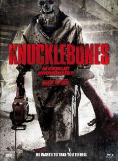 Knucklebones